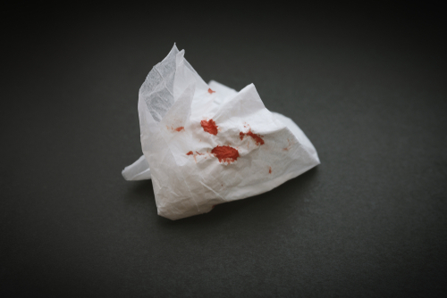 Foto de papel amassado com marcas de sangue após um episódio de tosse. Foto de papel amassado com marcas de sangue após um episódio de tosse.