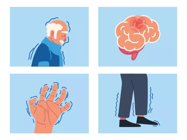 Illustration of human profile, brain, hand and legs with signs of Parkinson's Illustration of human profile, brain, hand and legs with signs of Parkinson's