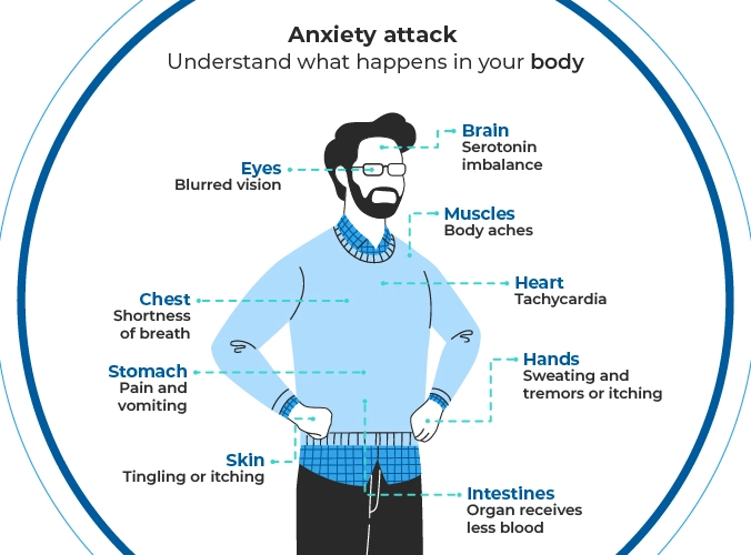 Illustration of a human body with arrows indicating the locations where symptoms manifest during an anxiety attack. The symptoms of anxiety during a crisis are: blurred vision, shortness of breath, pain and vomiting, tingling or itching, serotonin imbalance, tachycardia, less blood flow to the intestines, sweating, and tremors Illustration of a human body with arrows indicating the locations where symptoms manifest during an anxiety attack. The symptoms of anxiety during a crisis are: blurred vision, shortness of breath, pain and vomiting, tingling or itching, serotonin imbalance, tachycardia, less blood flow to the intestines, sweating, and tremors
