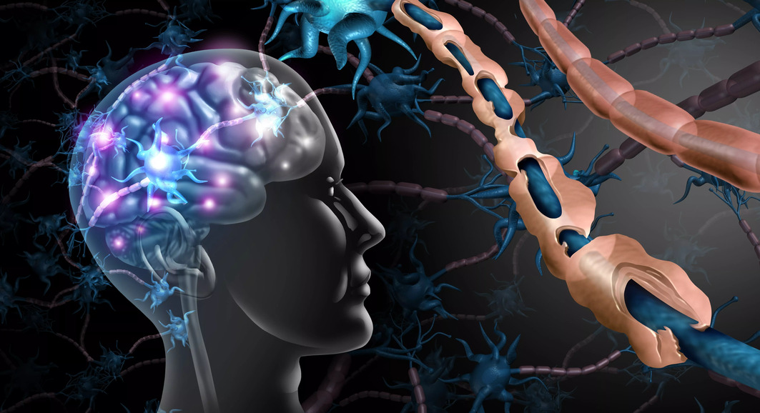 Imagem em 3D de um cérebro humano, ilustrando as conexões cerebrais Imagem em 3D de um cérebro humano, ilustrando as conexões cerebrais