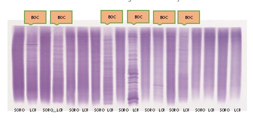 A figura demonstra 9 amostras de soro (sangue) e líquor (LCR) onde em 6 delas se encontra a presença de Bandas Oligoclonais (BOC) exclusivamente no LCR indicando parte do processo imunológico envolvido na Esclerose Múltipla. Este exame auxilia no diagnóstico da doença. A figura demonstra 9 amostras de soro (sangue) e líquor (LCR) onde em 6 delas se encontra a presença de Bandas Oligoclonais (BOC) exclusivamente no LCR indicando parte do processo imunológico envolvido na Esclerose Múltipla. Este exame auxilia no diagnóstico da doença.