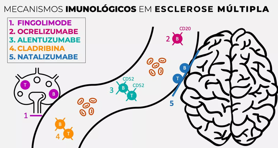 A ilustração apresenta os 5 mecanismos imunológicos na esclerose múltipla, que são: Fingolimode, Ocrelizumabe, Alentuzumabe, Cladribina e Natalizumabe. A ilustração apresenta os 5 mecanismos imunológicos na esclerose múltipla, que são: Fingolimode, Ocrelizumabe, Alentuzumabe, Cladribina e Natalizumabe.