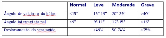 Tabela com dados dos tipos de joanetes determinados por avaliação radiográfica. Ângulo de valgismo do hálux: Normal (menor que 15º); Leve (15º a 19º); Moderada (20º a 39º) e Grave (maior que 40º). Ângulo intermetatarsal: Normal (menor que 9º); Leve (9º a 11º); Moderada (12º a 15º) e Grave (maior que 16º). Deslocamento do sesamóide: Normal (sem dados); Leve (menor que 49º); Moderada (50º a 74º) e Grave (maior que 75º). Tabela com dados dos tipos de joanetes determinados por avaliação radiográfica. Ângulo de valgismo do hálux: Normal (menor que 15º); Leve (15º a 19º); Moderada (20º a 39º) e Grave (maior que 40º). Ângulo intermetatarsal: Normal (menor que 9º); Leve (9º a 11º); Moderada (12º a 15º) e Grave (maior que 16º). Deslocamento do sesamóide: Normal (sem dados); Leve (menor que 49º); Moderada (50º a 74º) e Grave (maior que 75º).