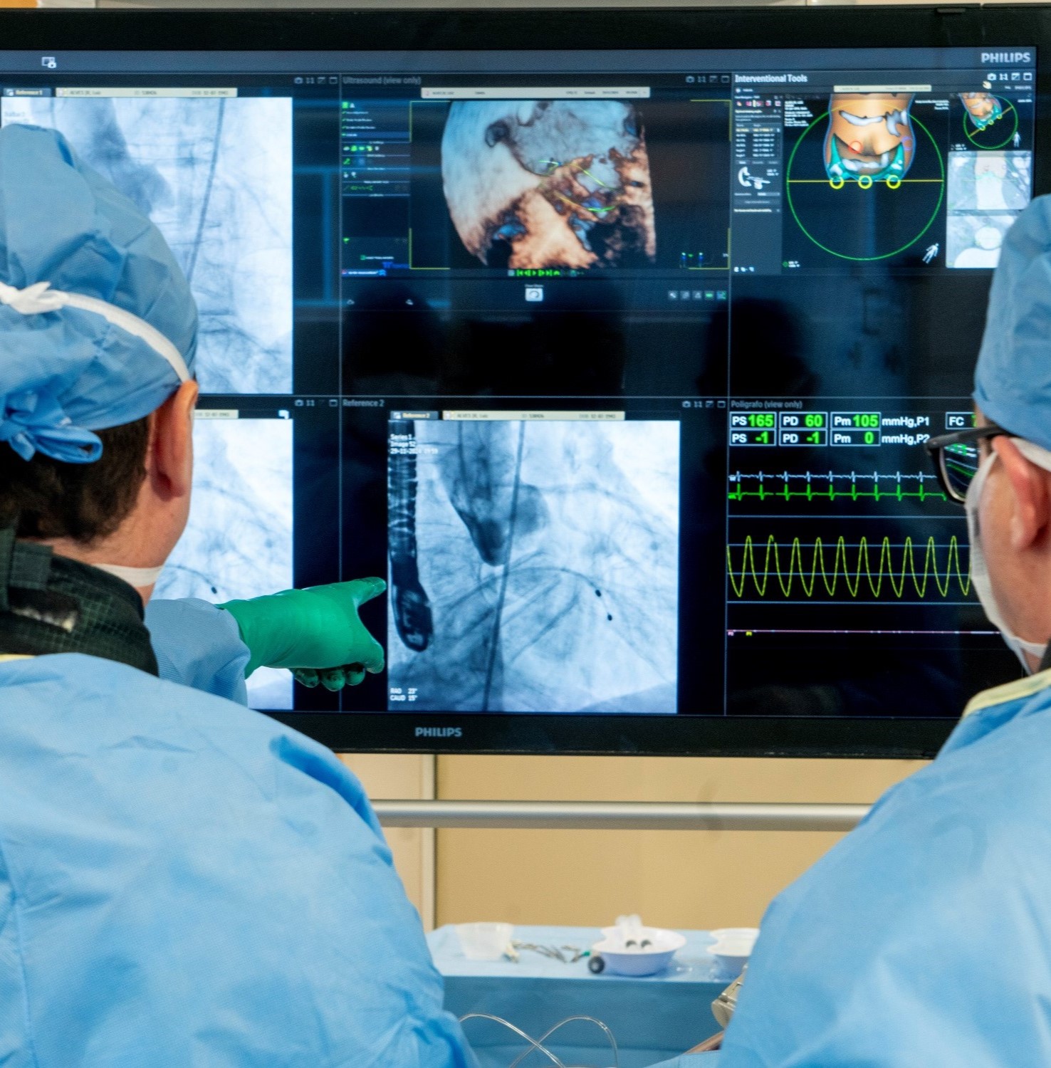 cirurgia-cardiaca-alta-complexidade cirurgia-cardiaca-alta-complexidade