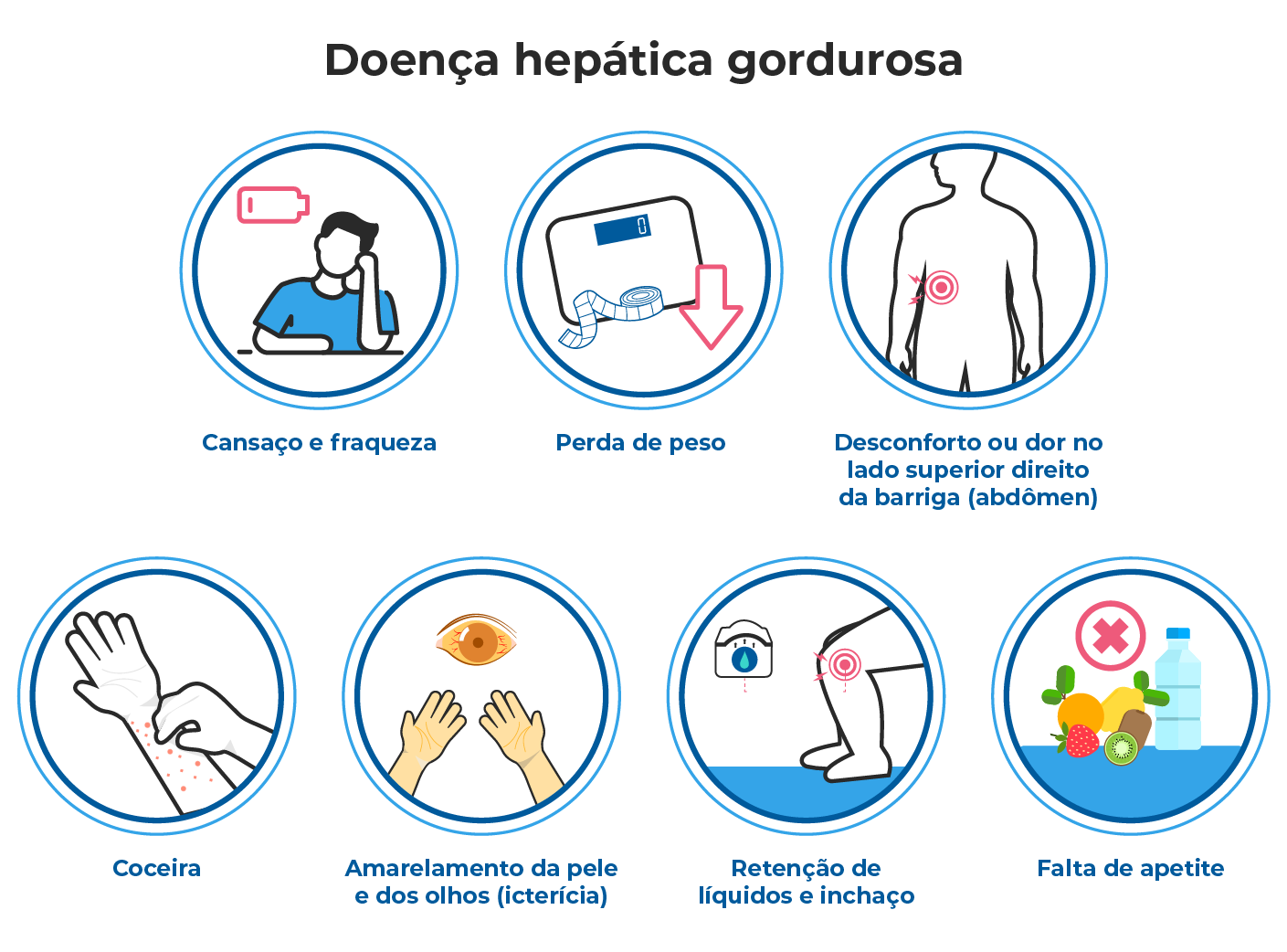 Ilustração mostra sintomas da esteatose hepática, como cansaço, perda de peso, dor abdominal, icterícia, relacionada à gordura no fígado, diabetes e obesidade. Ilustração mostra sintomas da esteatose hepática, como cansaço, perda de peso, dor abdominal, icterícia, relacionada à gordura no fígado, diabetes e obesidade.