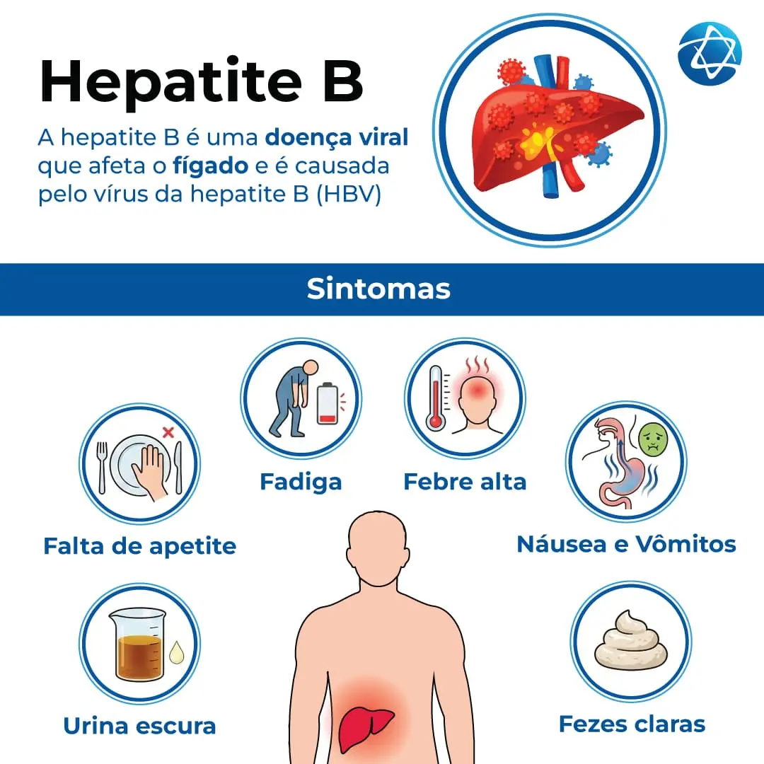 Hepatite B: Infográfico sobre a doença viral no fígado, destacando sintomas como fadiga, febre alta, urina escura e fezes claras. Hepatite B: Infográfico sobre a doença viral no fígado, destacando sintomas como fadiga, febre alta, urina escura e fezes claras.