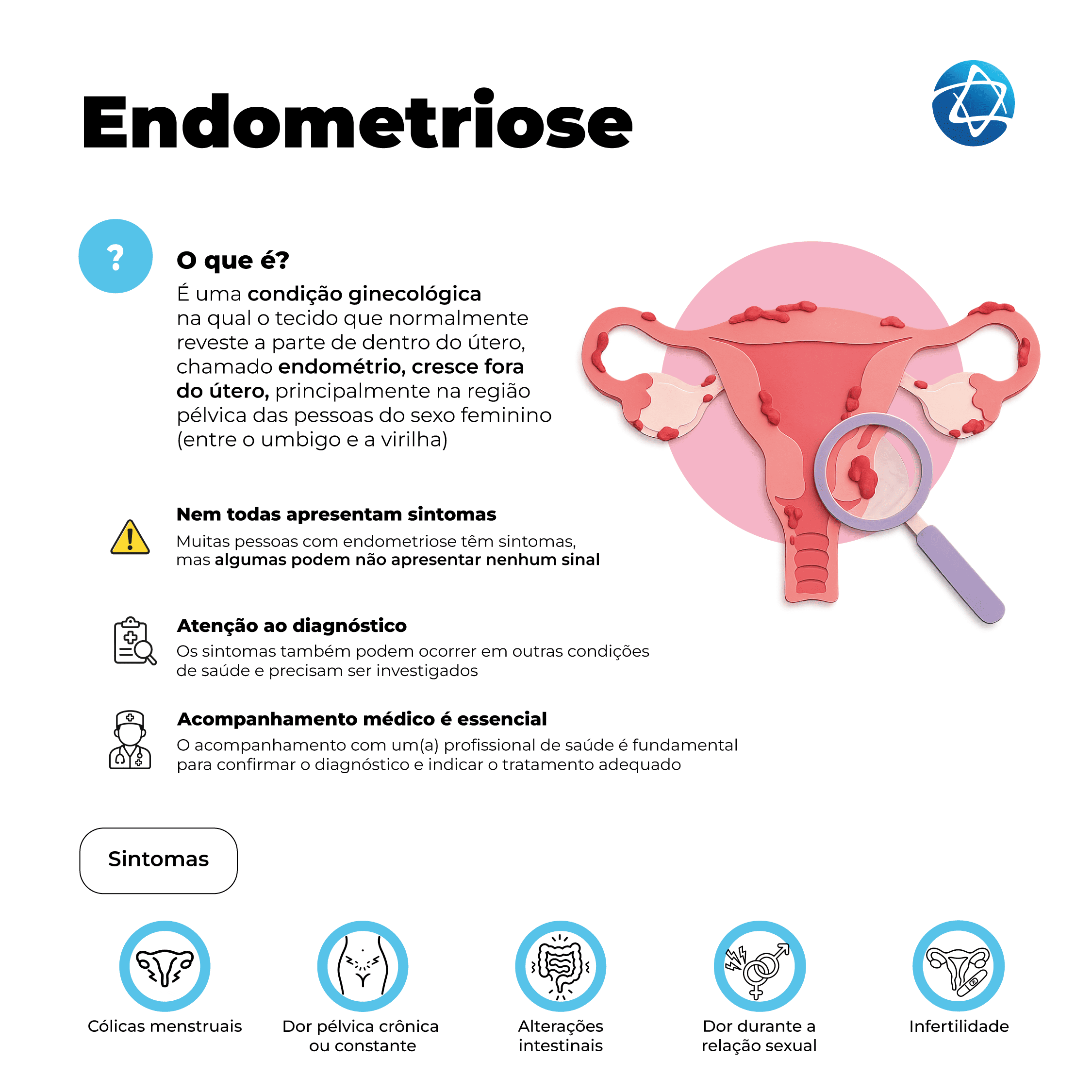 Infográfico sobre endometriose. Define a condição como o crescimento do tecido que normalmente reveste o útero, chamado endométrio, fora do útero, principalmente na região pélvica. Informa que nem todas as pessoas apresentam sintomas, reforça a importância do diagnóstico médico e lista sintomas como cólicas menstruais, dor pélvica crônica, alterações intestinais, dor durante a relação sexual e infertilidade. Infográfico sobre endometriose. Define a condição como o crescimento do tecido que normalmente reveste o útero, chamado endométrio, fora do útero, principalmente na região pélvica. Informa que nem todas as pessoas apresentam sintomas, reforça a importância do diagnóstico médico e lista sintomas como cólicas menstruais, dor pélvica crônica, alterações intestinais, dor durante a relação sexual e infertilidade.