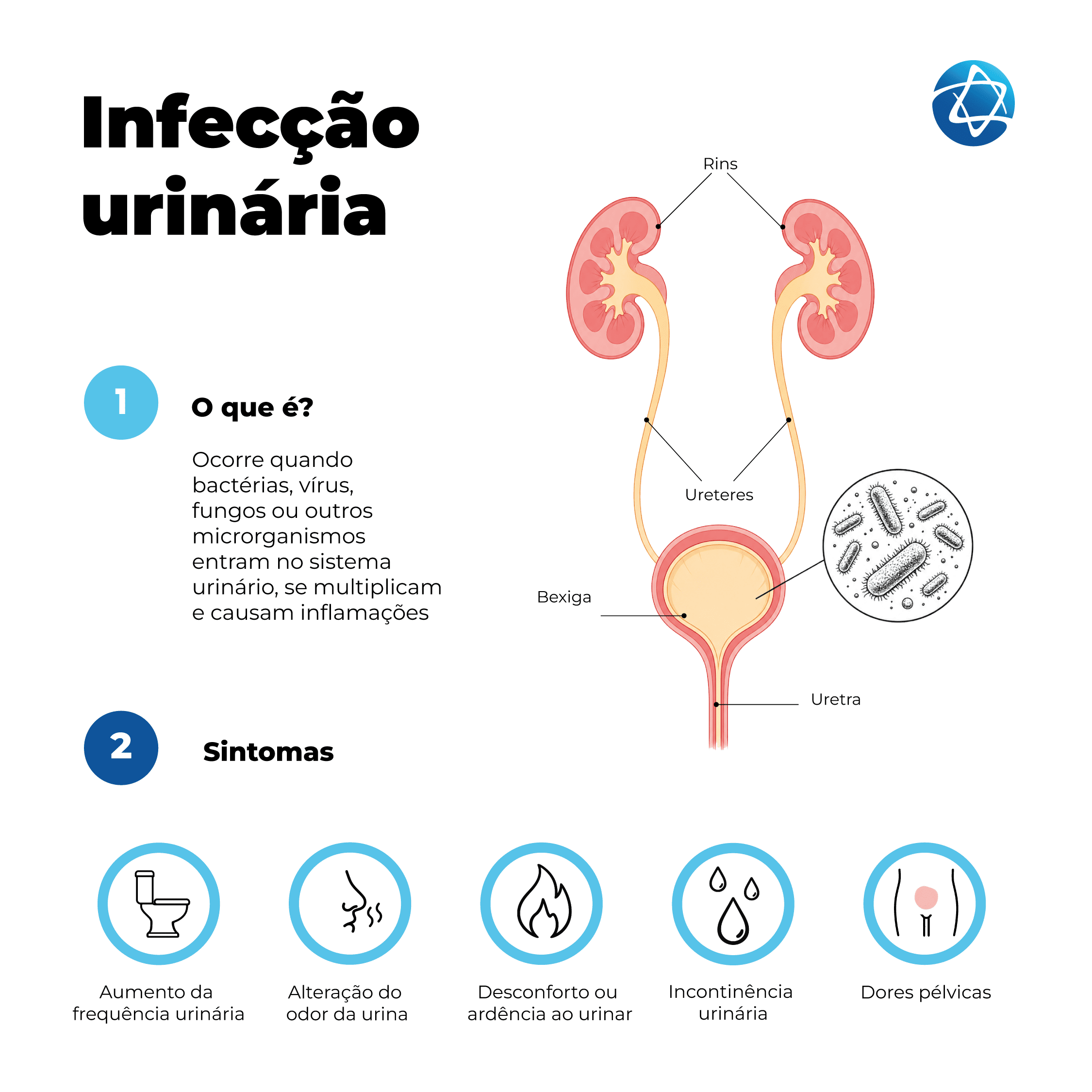 O infográfico sobre infecção urinária, também conhecida como cistite, mostra o sistema urinário humano com rins, ureteres, bexiga e uretra. A arte descreve a entrada de microrganismos, como bactérias, vírus ou fungos, e apresenta sintomas que incluem aumento da frequência urinária, alteração no odor, dor e ardência ao urinar, incontinência urinária e dor pélvica. O infográfico sobre infecção urinária, também conhecida como cistite, mostra o sistema urinário humano com rins, ureteres, bexiga e uretra. A arte descreve a entrada de microrganismos, como bactérias, vírus ou fungos, e apresenta sintomas que incluem aumento da frequência urinária, alteração no odor, dor e ardência ao urinar, incontinência urinária e dor pélvica.
