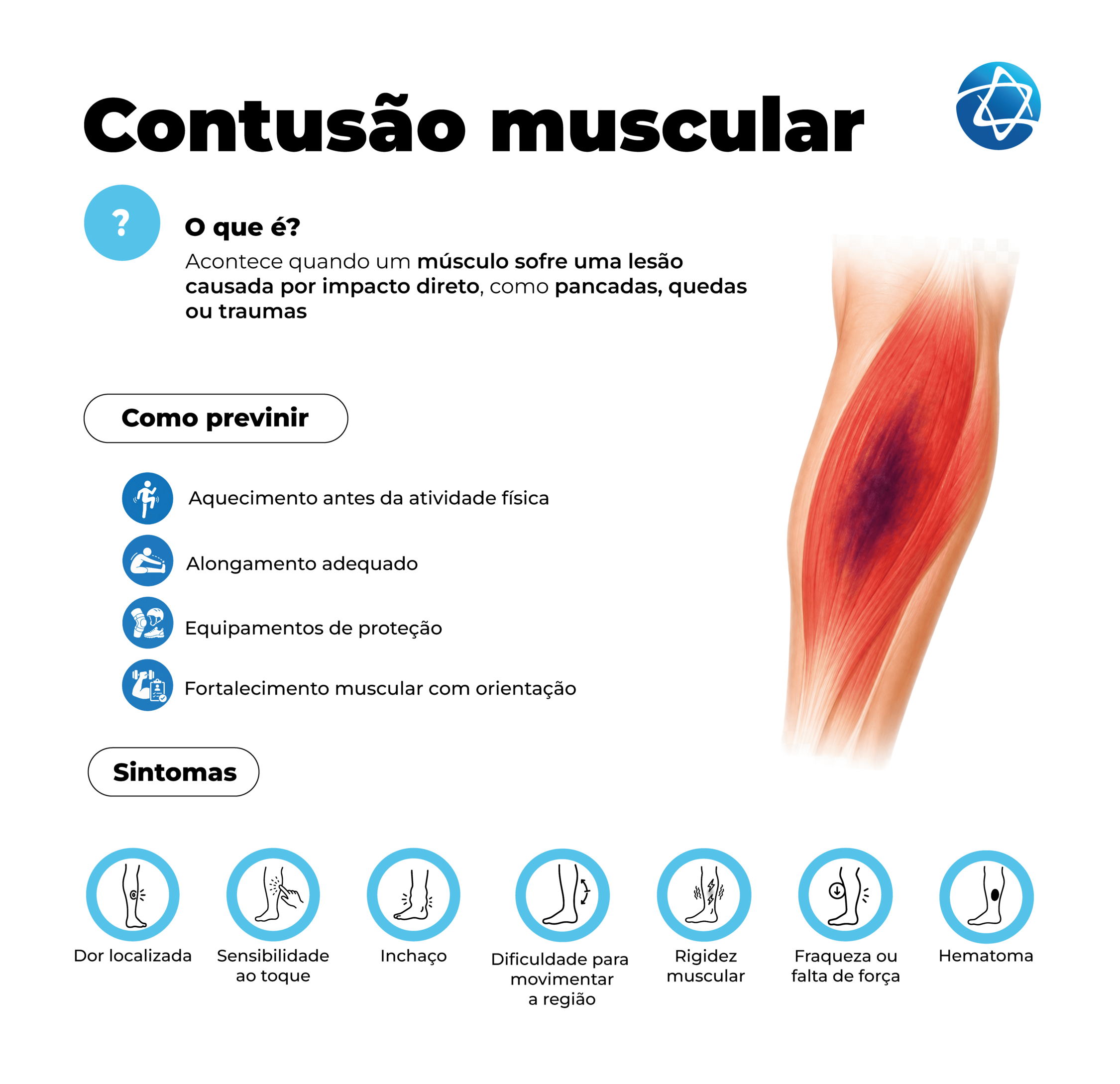 Infográfico sobre contusão muscular explicando que a lesão ocorre quando um músculo sofre impacto direto, como pancadas, quedas ou traumas. Apresenta formas de prevenção, incluindo aquecimento, alongamento, equipamentos de proteção e fortalecimento muscular, além de sintomas como dor localizada, sensibilidade ao toque, inchaço, rigidez, fraqueza e hematoma. Infográfico sobre contusão muscular explicando que a lesão ocorre quando um músculo sofre impacto direto, como pancadas, quedas ou traumas. Apresenta formas de prevenção, incluindo aquecimento, alongamento, equipamentos de proteção e fortalecimento muscular, além de sintomas como dor localizada, sensibilidade ao toque, inchaço, rigidez, fraqueza e hematoma.