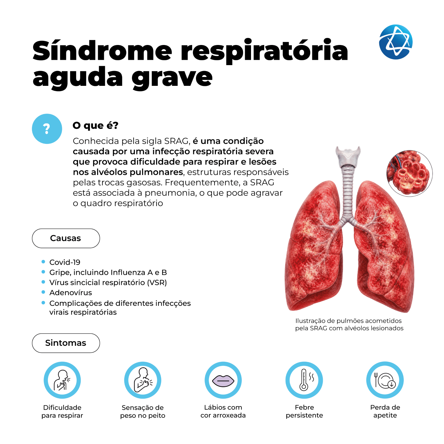 Infográfico sobre síndrome respiratória aguda grave, ou SRAG, explicando que é uma condição causada por infecção respiratória severa, com dificuldade para respirar e lesões nos alvéolos pulmonares. Apresenta causas como covid-19, gripe, VSR, adenovírus e complicações respiratórias, além de sintomas como falta de ar, peso no peito, lábios arroxeados, febre persistente e perda de apetite. Infográfico sobre síndrome respiratória aguda grave, ou SRAG, explicando que é uma condição causada por infecção respiratória severa, com dificuldade para respirar e lesões nos alvéolos pulmonares. Apresenta causas como covid-19, gripe, VSR, adenovírus e complicações respiratórias, além de sintomas como falta de ar, peso no peito, lábios arroxeados, febre persistente e perda de apetite.