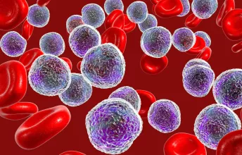 Linfoma de Hodgkin: Sintomas, Causas e Tratamentos