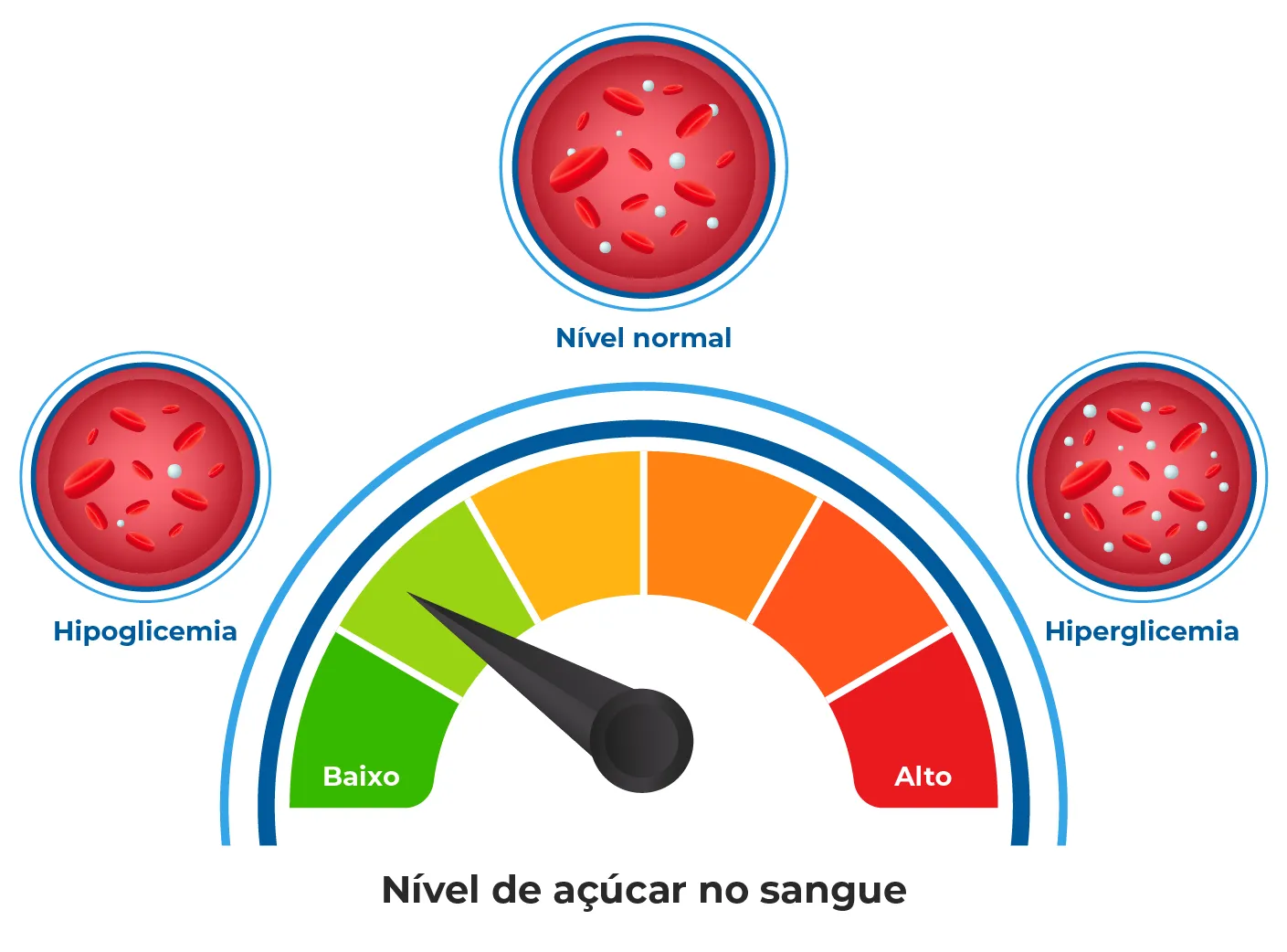 Hipoglicemia: Sintomas, Causas e Tratamentos